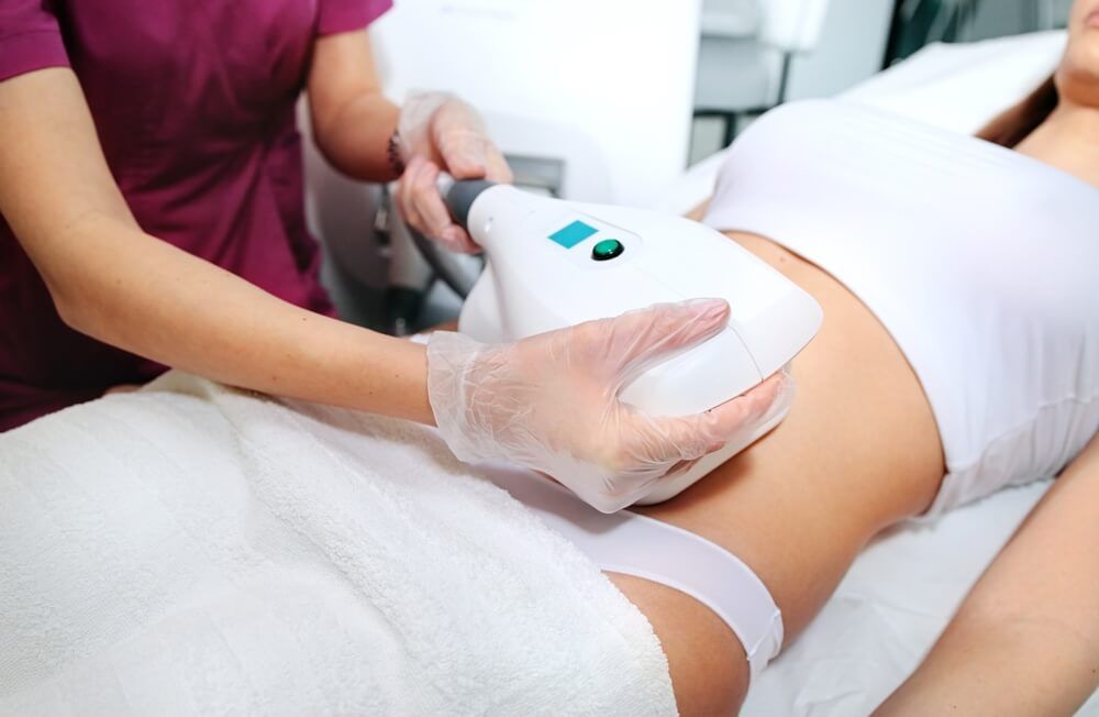 liposuction on belly